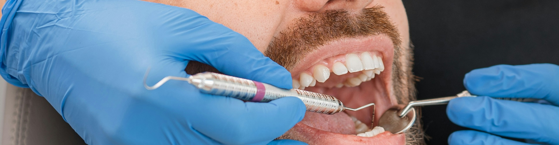 Gloved hands using dental tools in man's mouth.